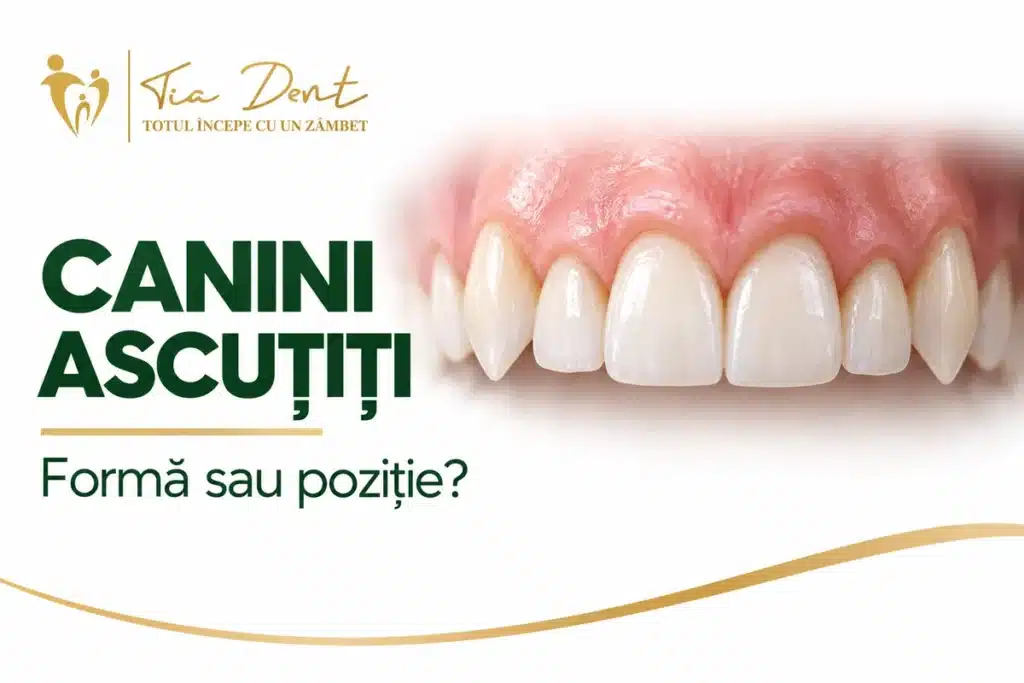 Canini cu vârfuri accentuate, într-o ilustrație a formei dinților.