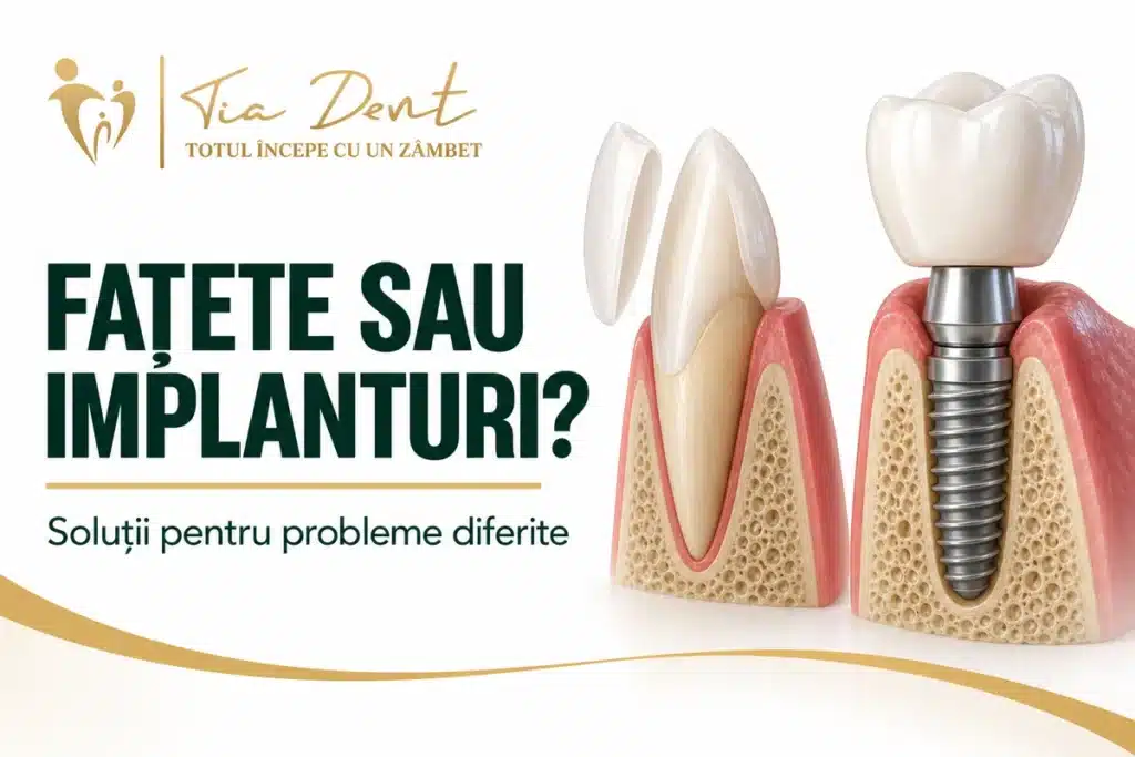 Comparație ilustrată între o fațetă pe dinte natural și o coroană pe implant.