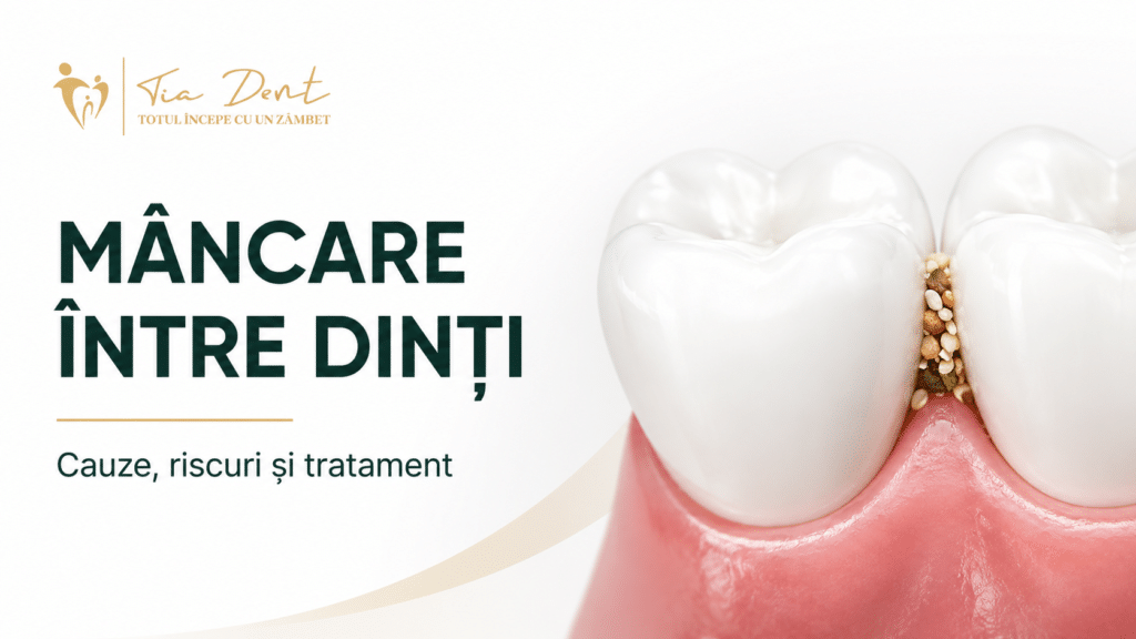 Mâncare blocată între doi dinți, ilustrând o capcană alimentară dentară