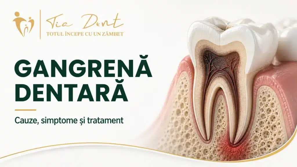Secțiune de molar cu pulpă necrozată și inflamație apicală, Tia Dent Iași
