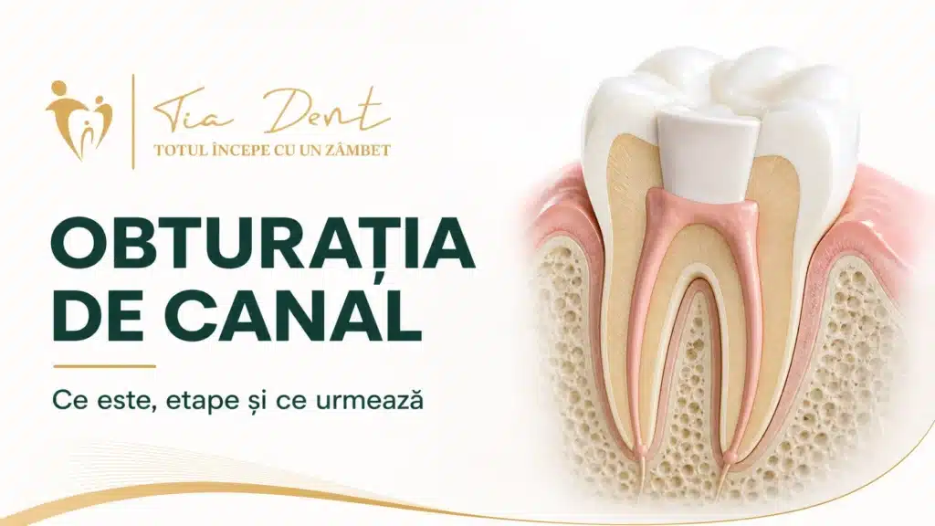 Secțiune de molar cu obturația canalelor radiculare la Tia Dent Iași