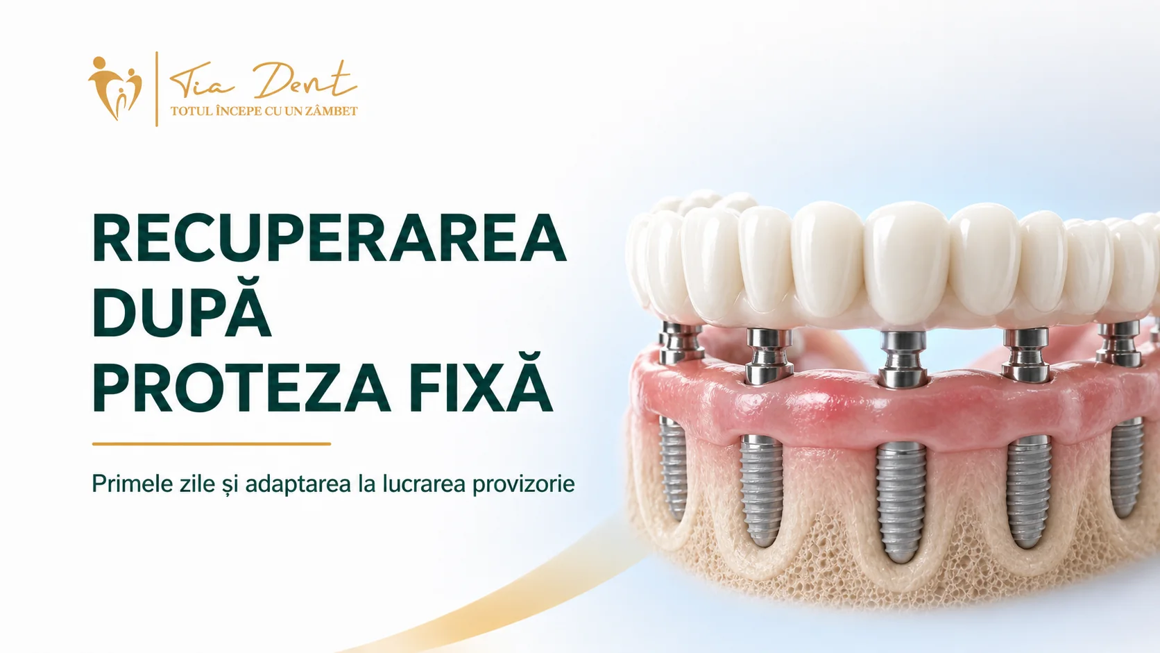 Recuperarea după proteza fixă pe implanturi: ghid pentru primele zile